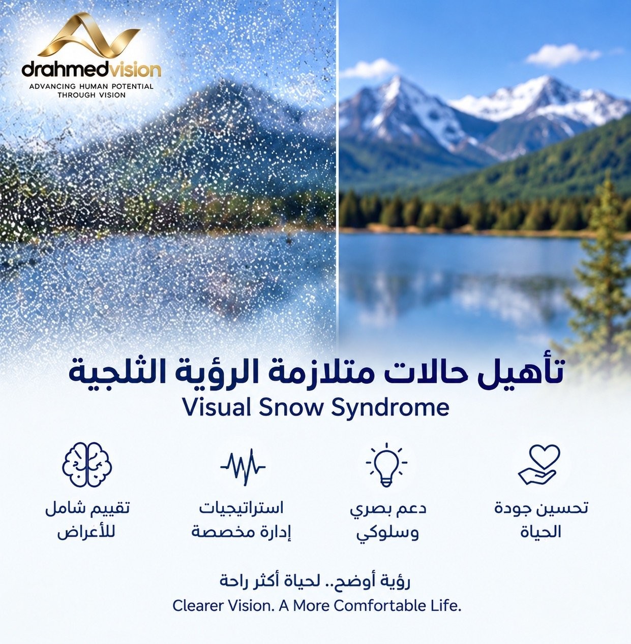 متلازمة الثلج البصري