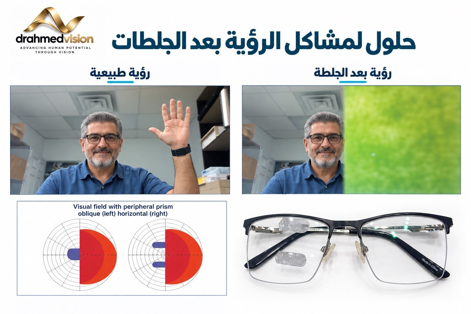 الرؤية بعد السكتة الدماغية