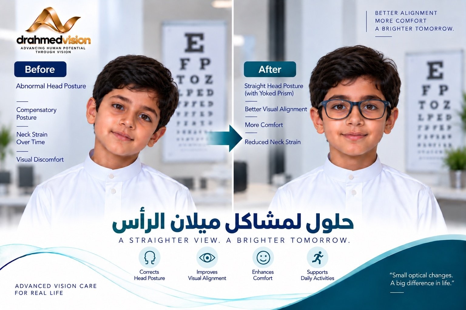 ميلان الرأس المرتبط بمشكلات الرؤية